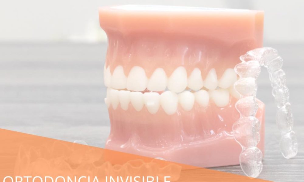 La Ortodoncia invisible. Clínica Dr. David Martínez